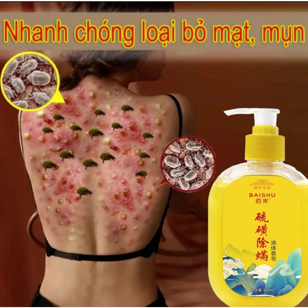 Sữa  tắm trắng da sữa tắm mụn lưng sữa tắm viêm nang lông 400ML chiết xuất 100% suối lưu huỳnh tự nhiên.