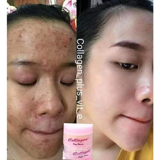 Cặp Kem Ngày Đêm + Soap [701]