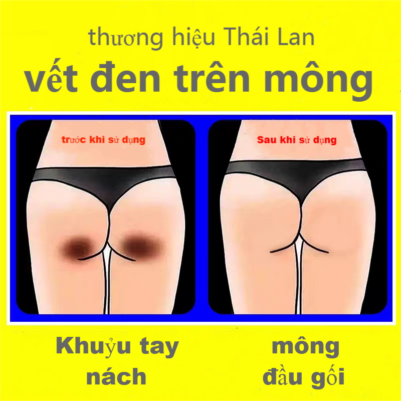 nước Thái Lan/kem dưỡng nách/kem giảm thâm mông/trắng nách/thâm đầu gối 30g