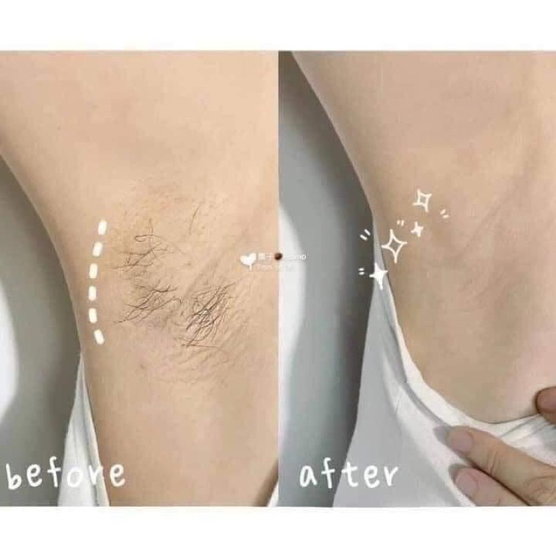 Kem Tẩy lông Veet cho vùng tay,chân và vùng bikini và dưới cánh tay 150G có tặng kèm bông.