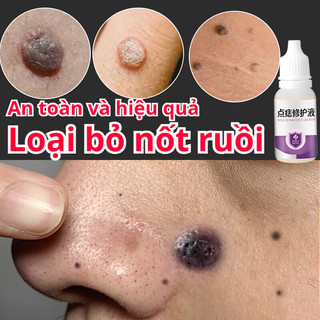 Kem tẩy nốt ruồi Gel Tẩy Nốt Ruồi loại bỏ thẻ da Tẩy Nốt Ruồi Mụn Cơm Mụn Cóc Mụn Thịt 10ml Chất lỏng khuẩn sửa chữa da