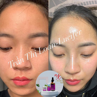 Tế Bào Gốc phục hồi EGF Lucifer