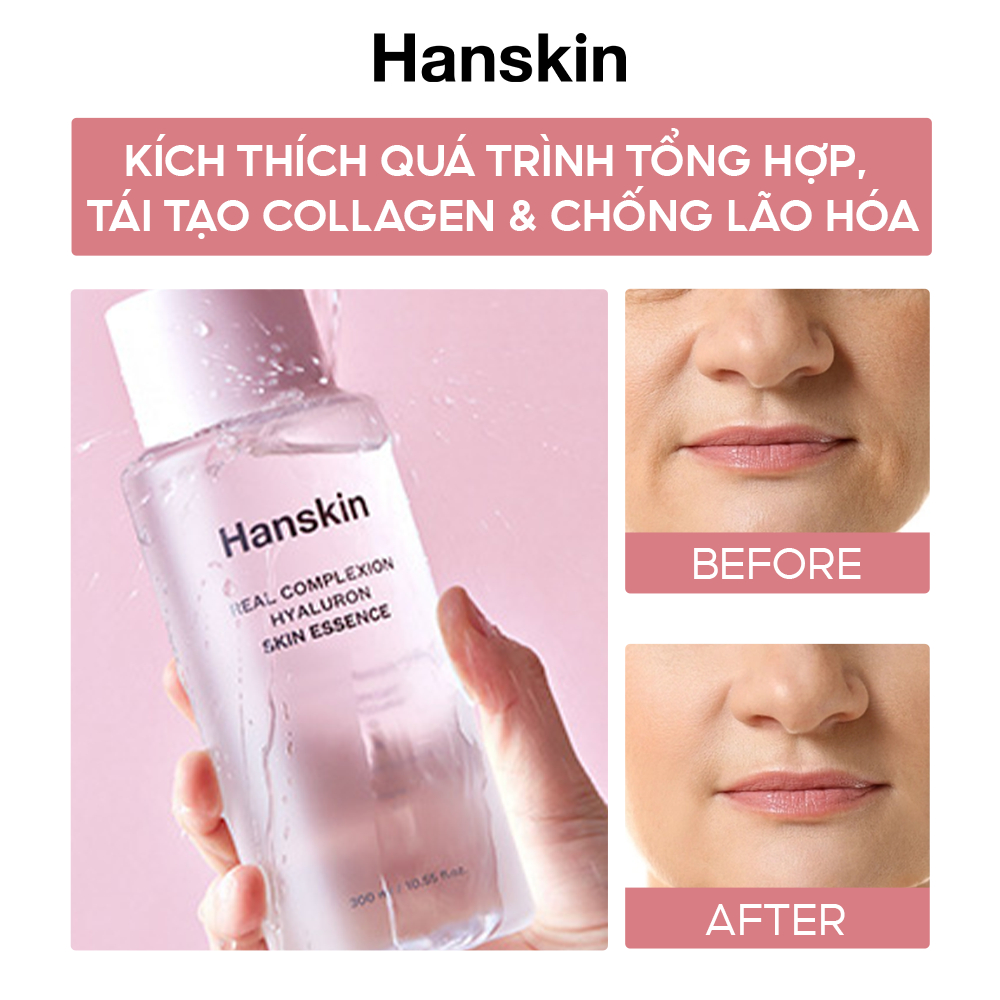 Nước hoa hồng cấp ẩm Hanskin Real Complexion Hyaluron Skin Essence Toner