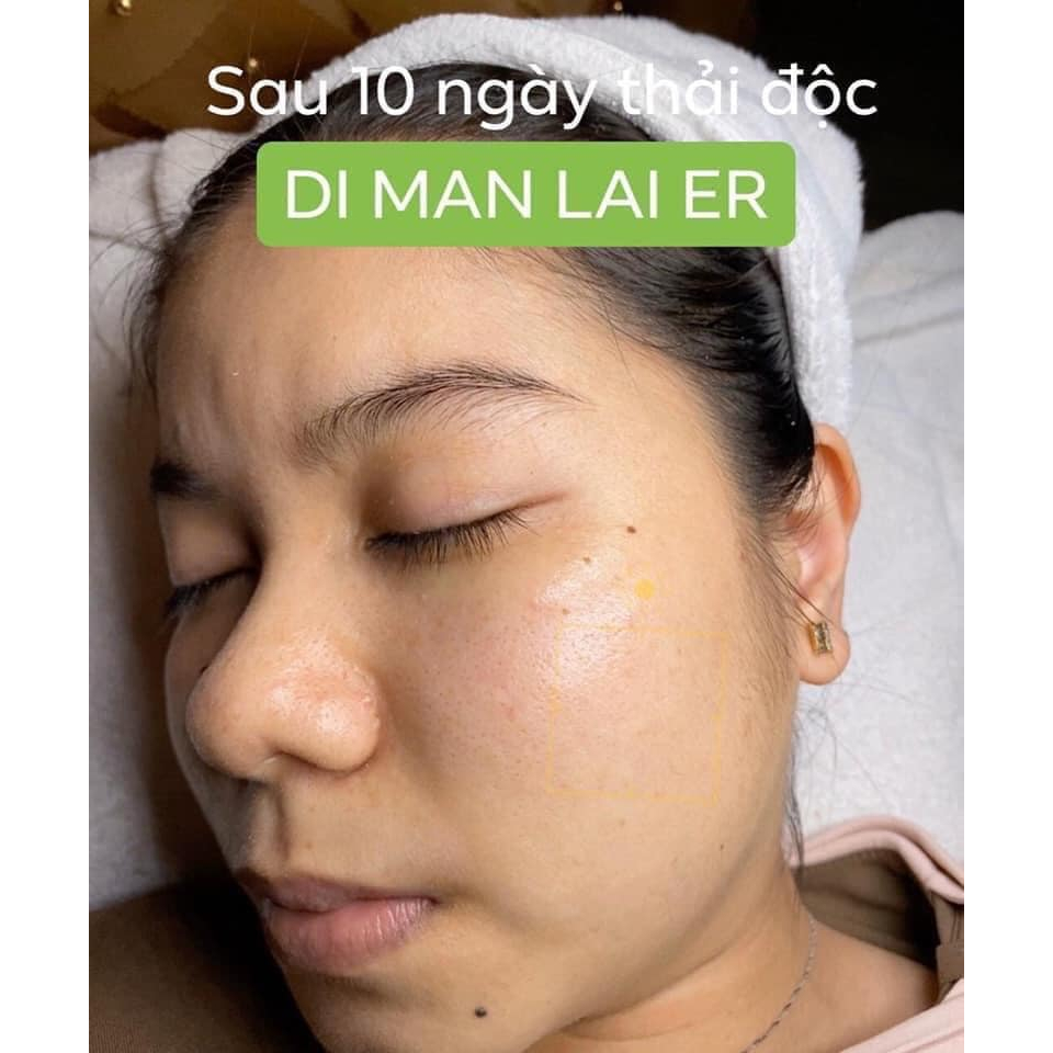 Tinh Chất Đào Thải và Trẻ Hoá Melanin Detox Dimanlaier 10ml