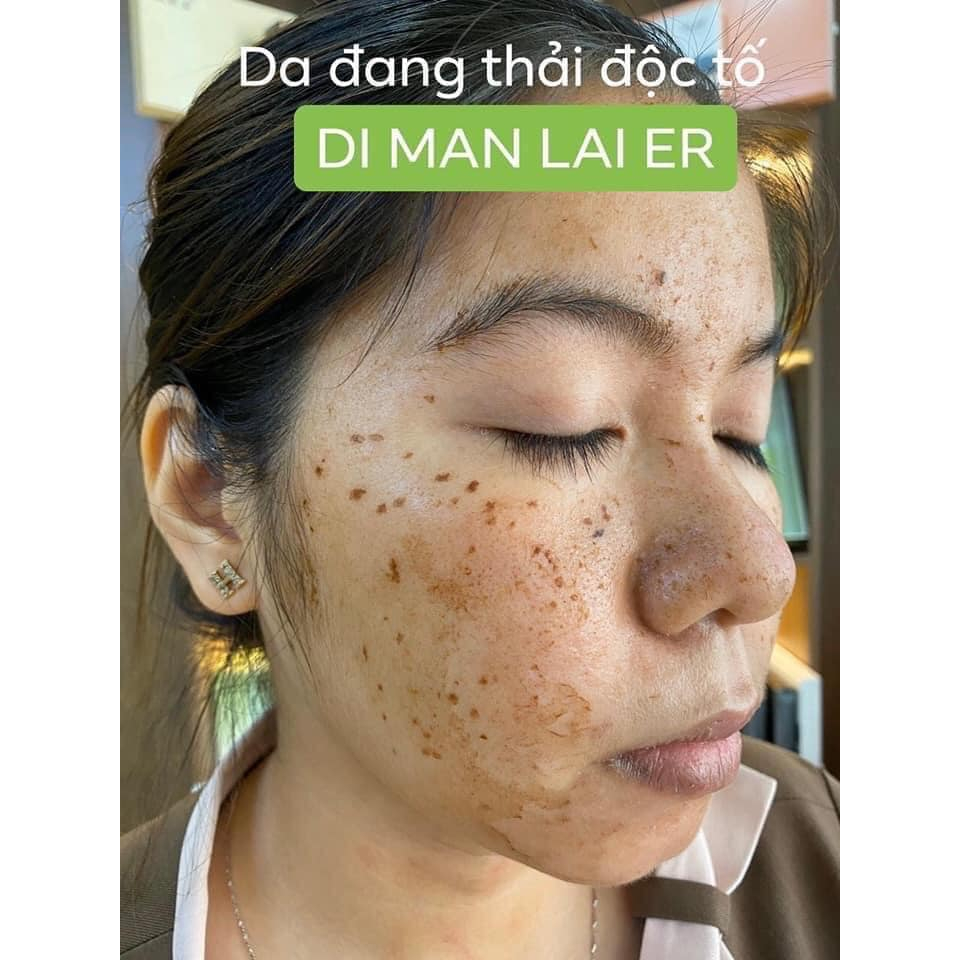 Tinh Chất Đào Thải và Trẻ Hoá Melanin Detox Dimanlaier 10ml