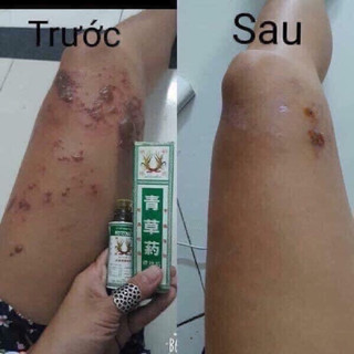 Dầu Bông Lúa Thái Lan-Chai Lớn 24ml