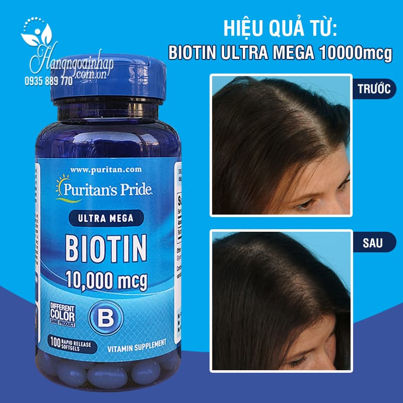 Viên uống giúp mọc tóc, giảm rụng tóc Puritan's Pride Ultra Mega Biotin 10000 mcg 100 viên của Mỹ(HÀNG XÁCH TAY)