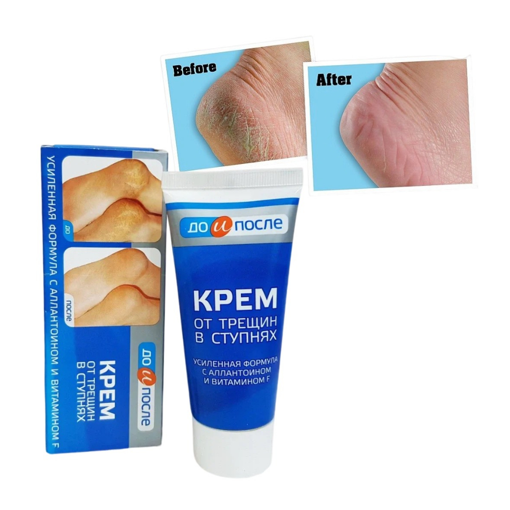 Kem nẻ gót chân Kpem Foot Cream giảm nẻ chân nứt chân khô da chân dưỡng gót chân