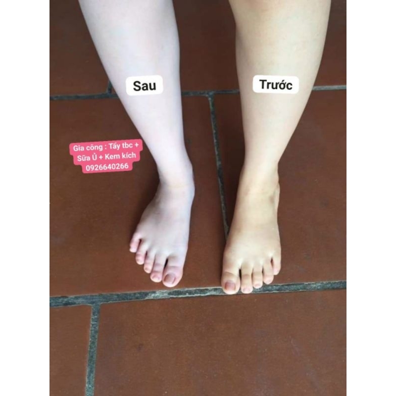 Tắm Trắng Body Siêu Trắng