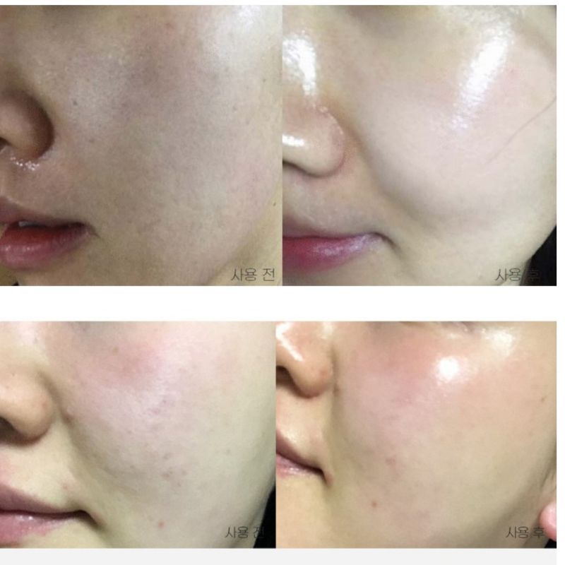 KEM DƯỠNG SPICULE DAILY CREAM SCD