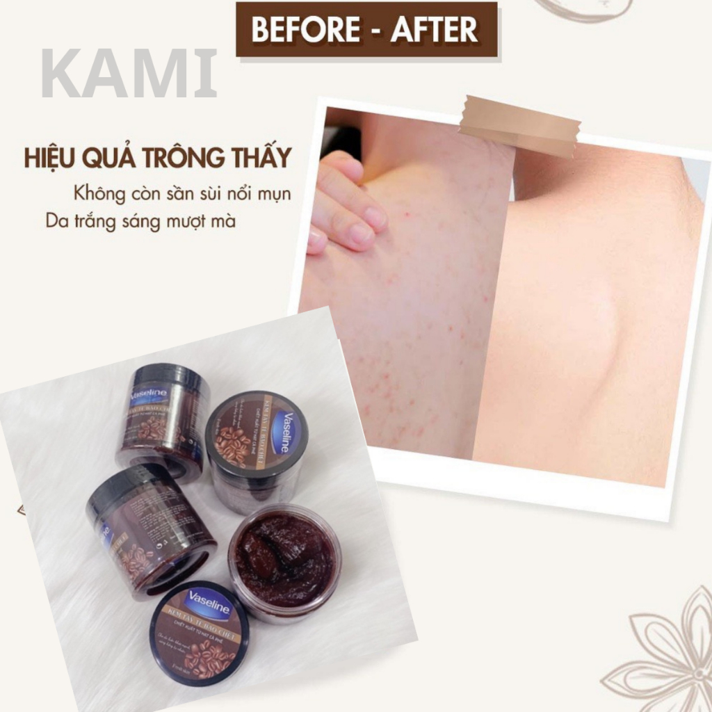 Kem Gel Tẩy Tế Bào Chết Body Toàn Thân Cà Phê Vaseline 200g Cấp Ẩm Trắng Sáng Da - KAMI