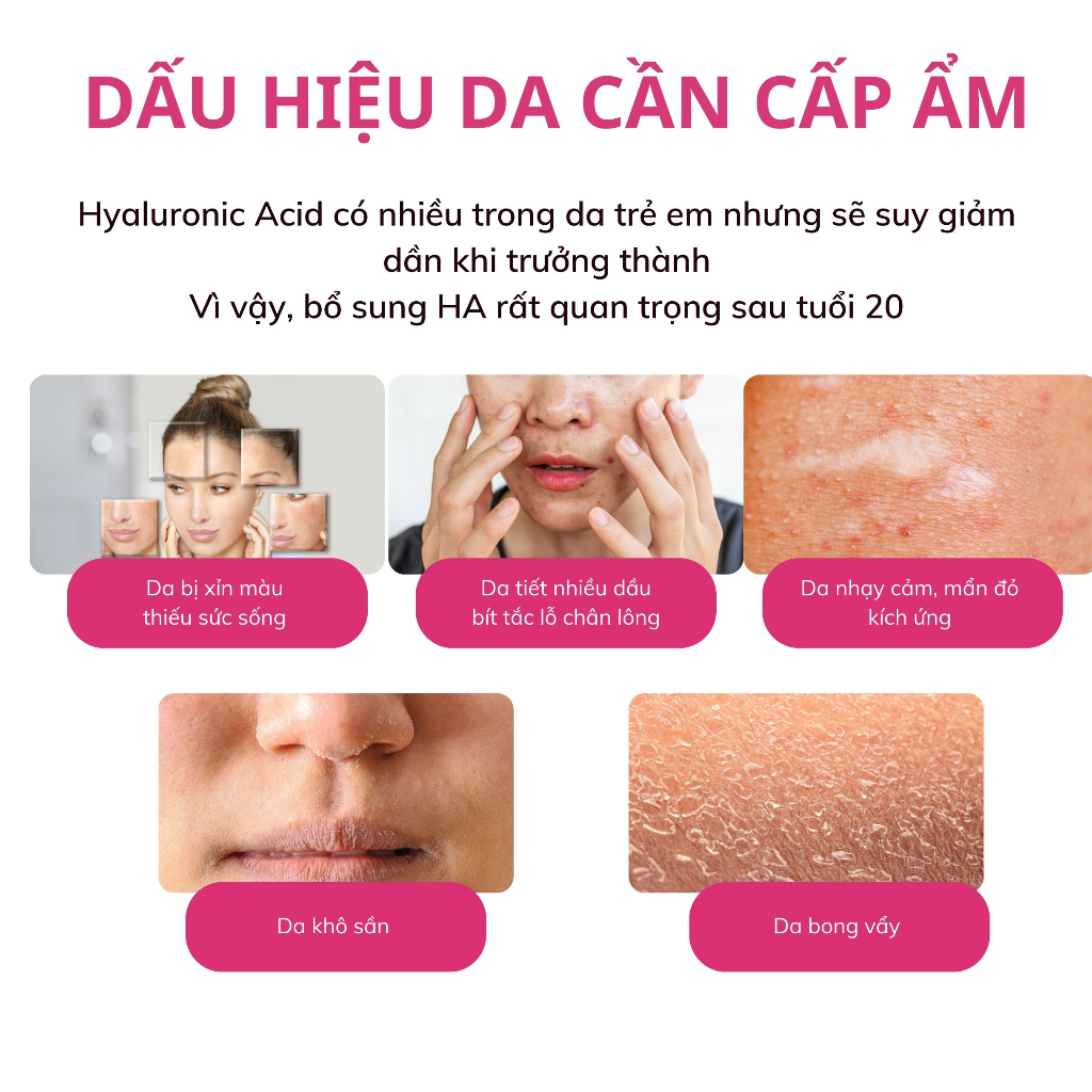 Viên Uống Cấp Ẩm Cho Da BB LAB Hyaluronic Acid Giúp Làm Giảm Nếp Nhăn, Đem Lại Làn Da Mịn Màng, Căng Bóng Hộp 30 Viên