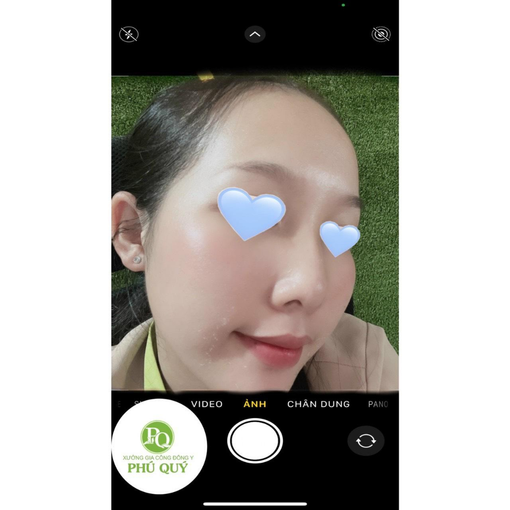 Vi Kim Thảo Dược