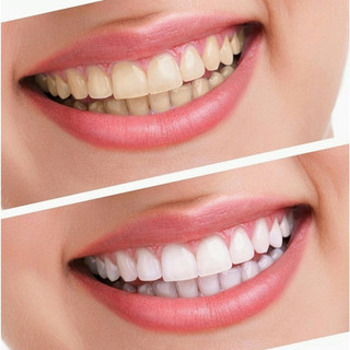 Kem đánh răng Crest 3D White Advanced Whitening 147gram / tuýp (mẫu mới 2022)