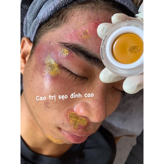 CAO NGHỆ DOCTOR QUEEN 21/8/2025