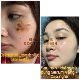 CAO NGHỆ DOCTOR QUEEN 21/8/2025