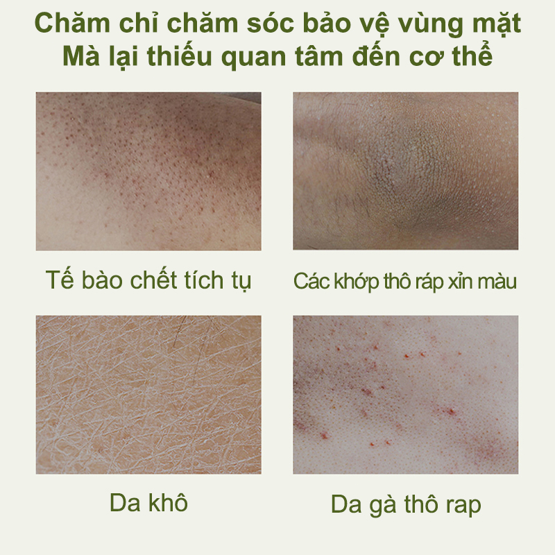 Kem tẩy tế bào chết cơ thể Tẩy tế bào chết  body da mặt 250G Loại bỏ nổi da gà và da xỉn màu
