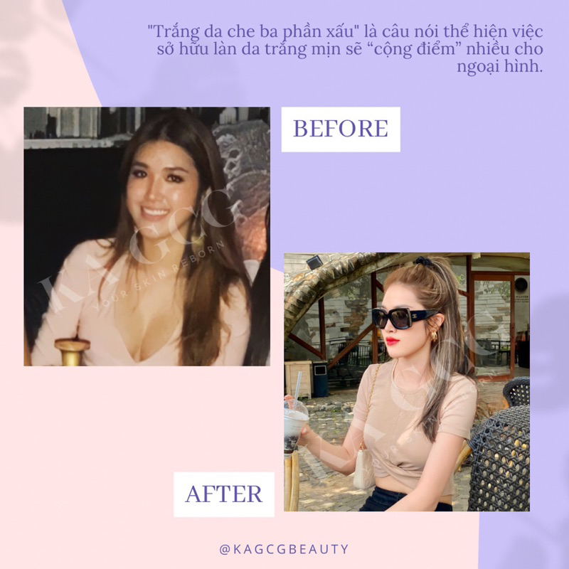 Kem Dưỡng Thể Giúp Làm Trắng Da Tăng Cường - Whitening Body Cream