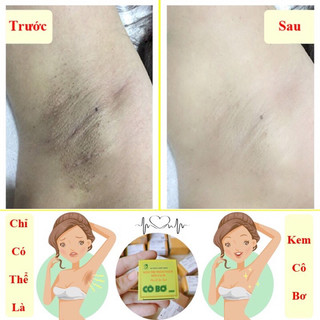 Kem cô bơ, giảm thâm nách