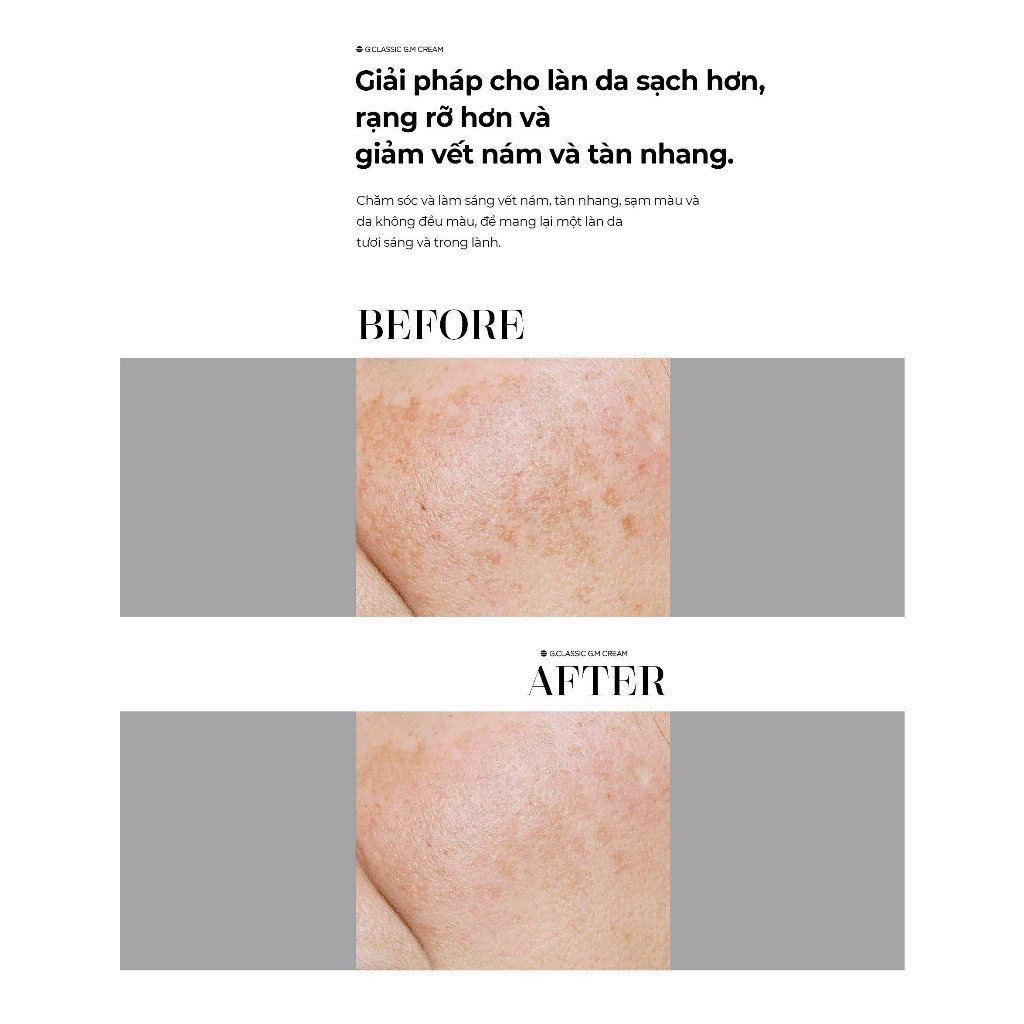 Kem dưỡng G.M Cream Gclassic - dưỡng trắng da, giảm nám, tàn nhang 50ml Bebalance
