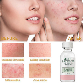 Chấm mụn Mario Badescu Drying Lotion