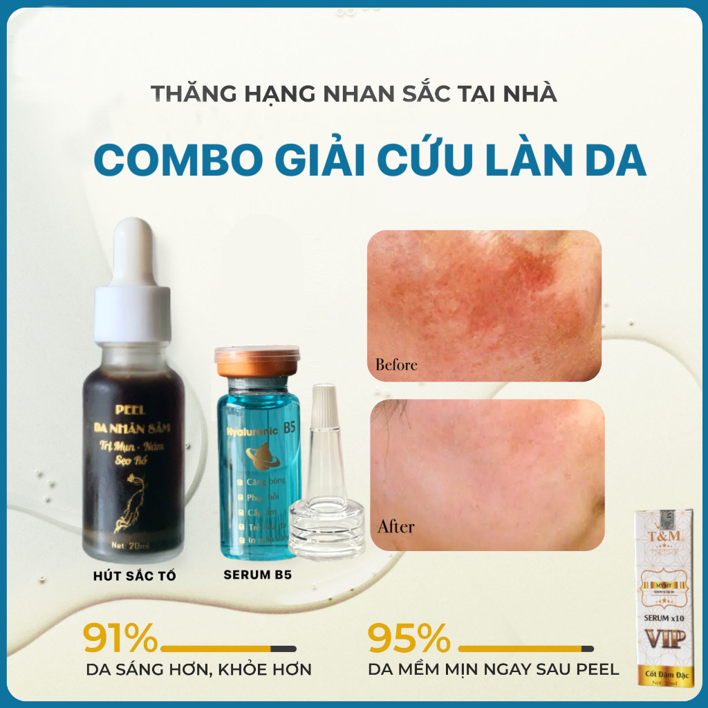 Hút Sắc Tố Bong Nhanh