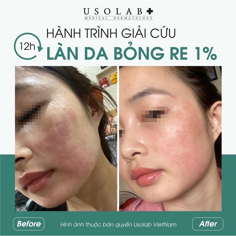 Kem dưỡng phục hồi Vitamin K Cream Usolab dung tích 50ml