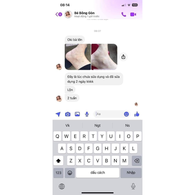 XẢ KHO combo 2 lọ mờ thâm jiuhe  , Jiuhechuẩn thanh tô  Á