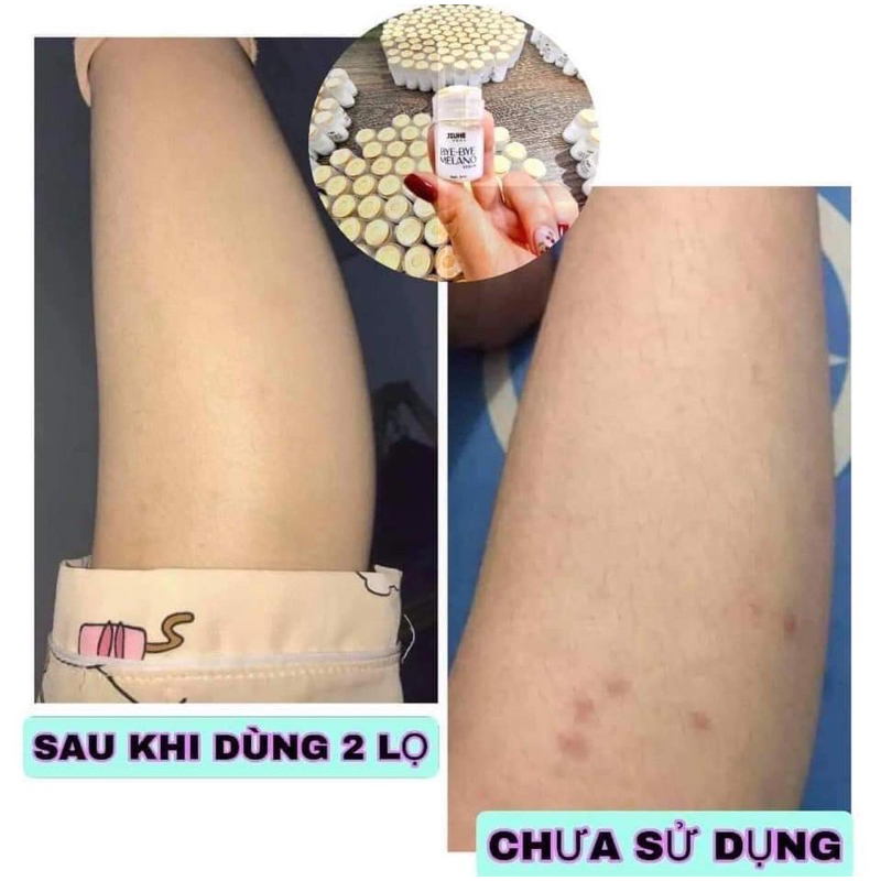 XẢ KHO combo 2 lọ mờ thâm jiuhe  , Jiuhechuẩn thanh tô  Á