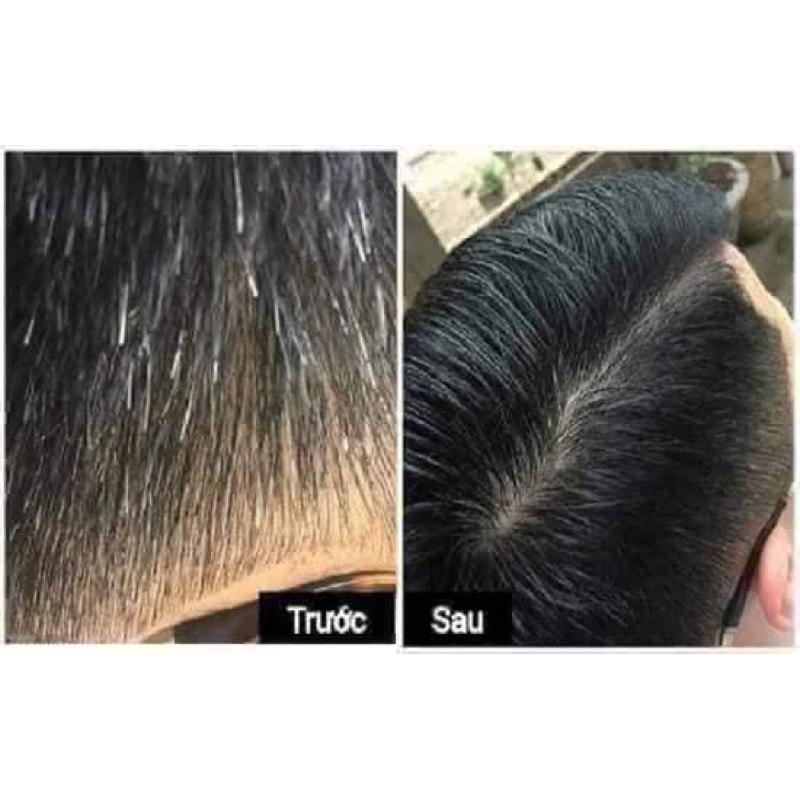 1 Kg Hà thủ ô thái lát chế đỗ đen xịn nhất