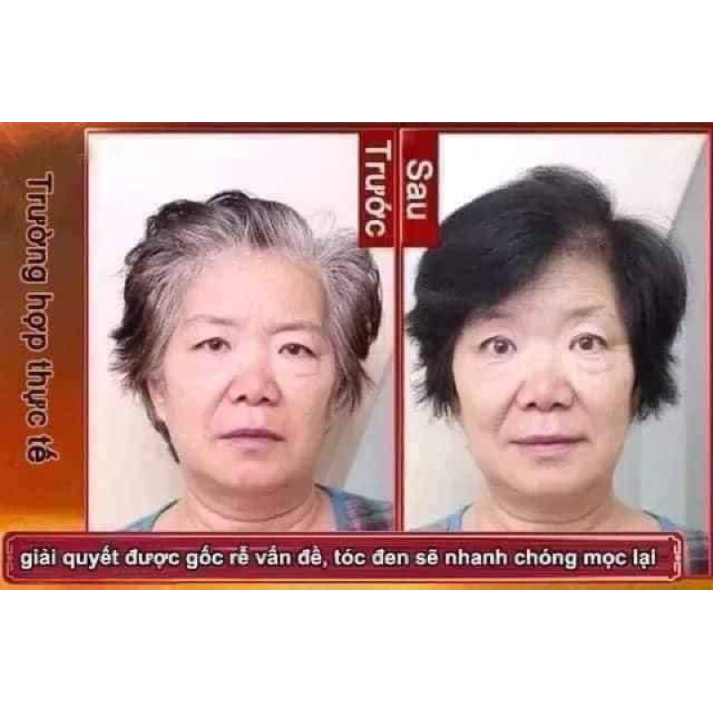 1 Kg Hà thủ ô thái lát chế đỗ đen xịn nhất