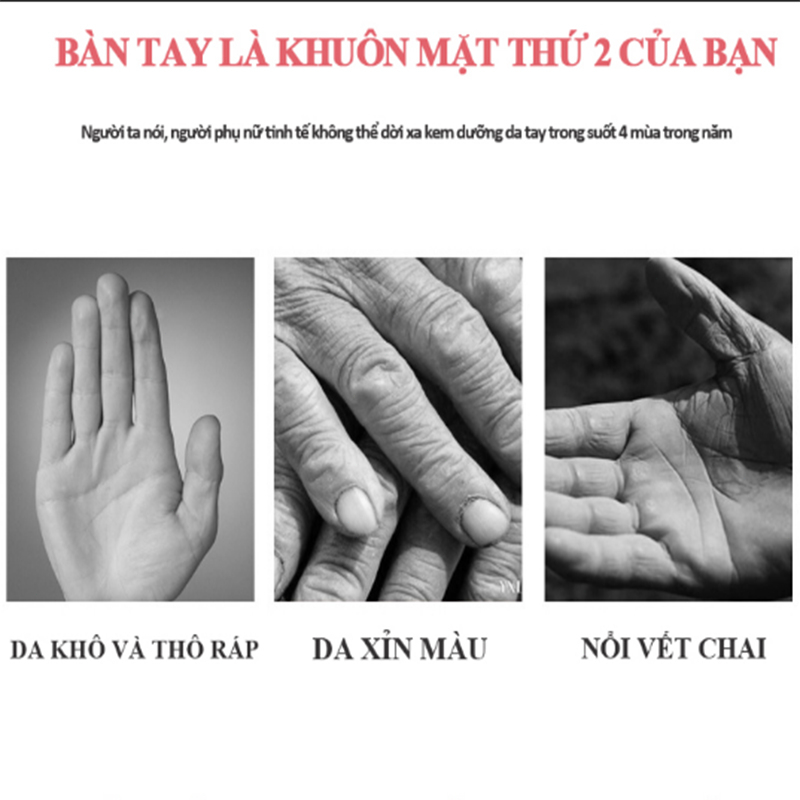 Kem dưỡng da tay Nicotinamide Giảm nếp nhăn gân tay dưỡng ẩm chống lão hóa dưỡng da tay trẻ hóa da trắng da 80g