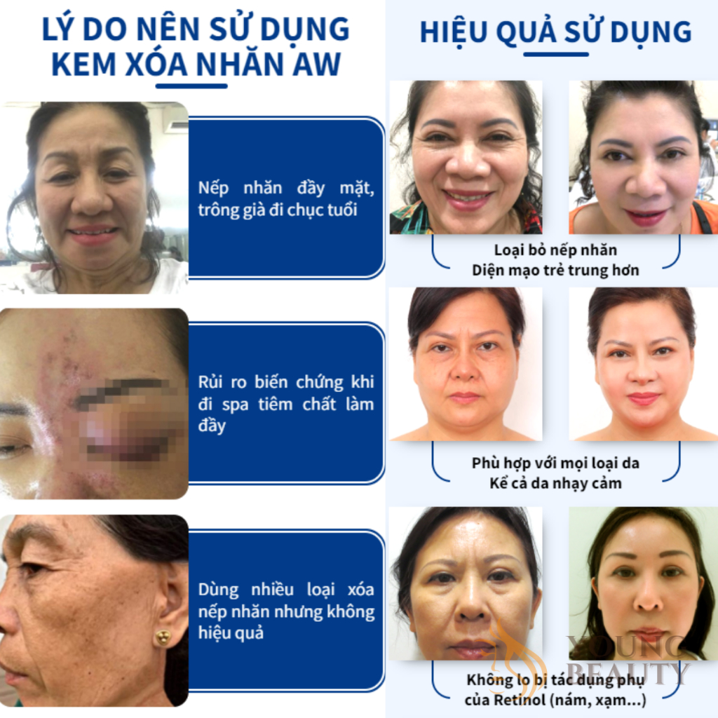 Kem xóa nếp nhăn AW - Kem AW xóa nếp nhăn chống lão hóa, giữ ẩm, căng bóng, mang lại làn da trẻ trung - YOUNG BEAUTY