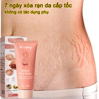 Kem rạn da Kem rạn da cho bà bầu 50g  Kem xoá rạn da sau sinh làm mờ vết thâm tăng độ đàn hồi cho da làm trắng