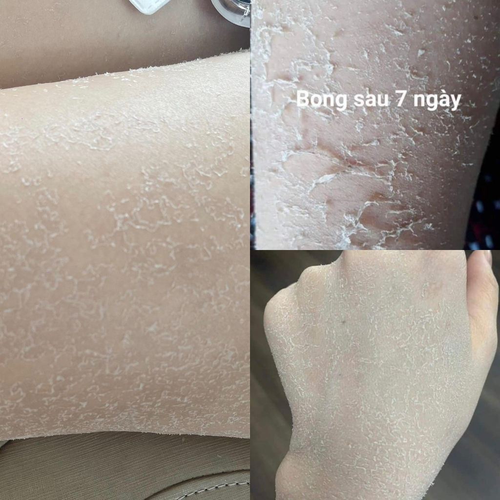 Kem Body Bong Da -  Tái Tạo Da Trắng Sáng dành cho da ngâm da đen chai lì, da không ăn kem, da thâm sạm