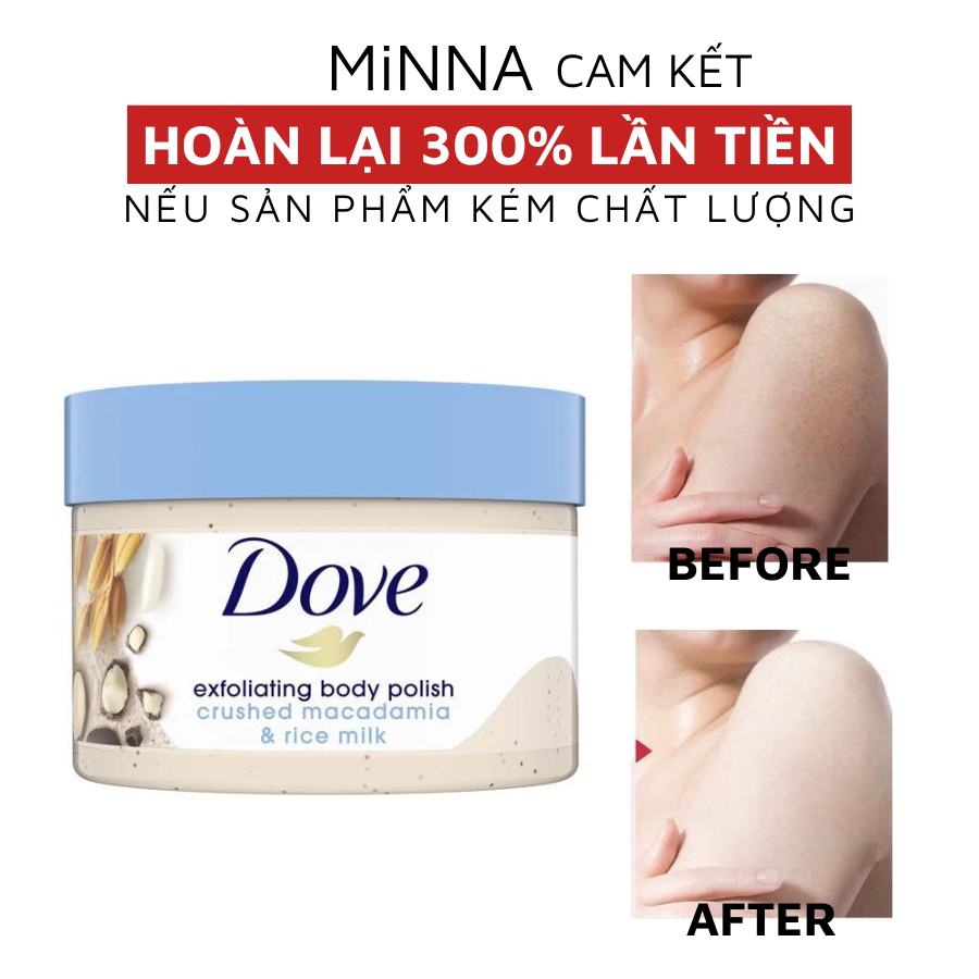 [Bản Mỹ] Tẩy Da, Tẩy Tế Bào Chết Body Dove Macadamia Bản Mỹ 298gr Exfoliating Body, Giúp Sáng Mịn Chăm Sóc Da