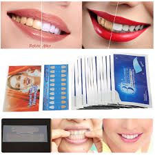 Miếng dán trắng răng tiện lợi 3D White Teeth Whitening Strips [Gói 2 miếng]