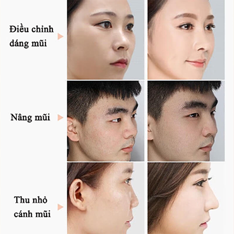 Serum cao mũi Tinh dầu nâng mũi Tinh dầu ũi Sụn nâ Định hình mũi 10ml Thu nhỏ cánh mũi Nâng sống mũi