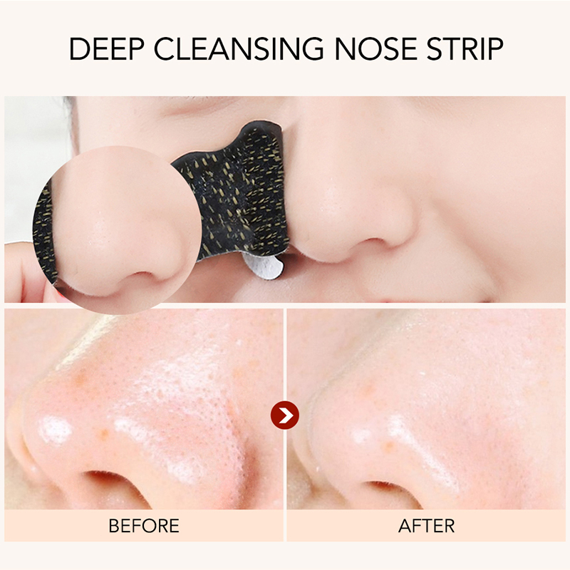 Miếng dán mũi lột mụn đầu đen làm sạch sâu lỗ chân lông