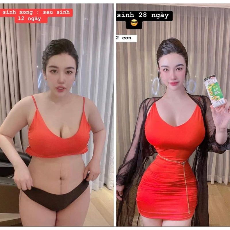 Viên Uống Xổ Mỡ Súp Lơ Xanh Slim Fit Giảm Mạnh Bụng + Đùi