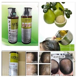 DẦU GỘI BƯỞI ANWANY NGĂN RỤNG TÓC 500 Ml [Wego_Cosmetics]