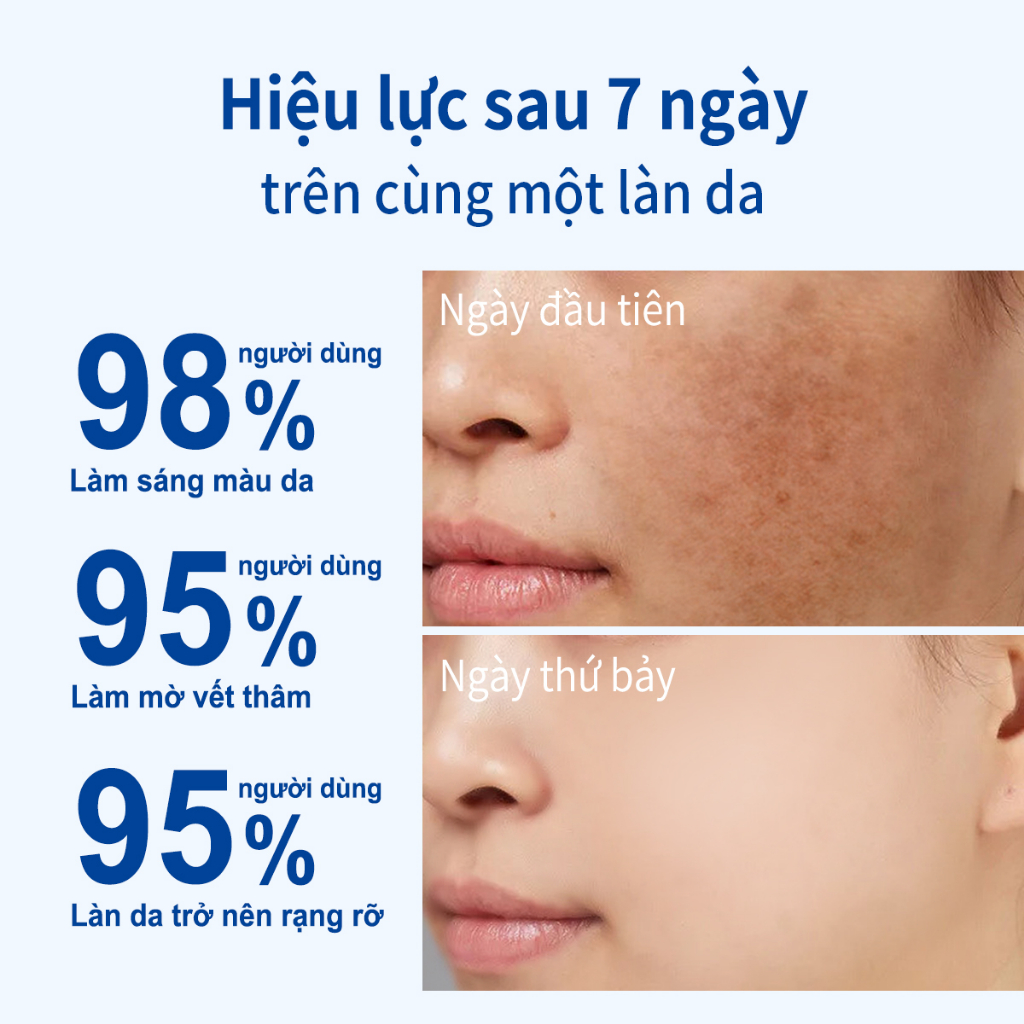 AISASEA làm trắng 5%Niacinamide+3%arbutin+ 3%panthenol 20ml thâm Làm sáng màu da làm trắng HyaluronicSerum