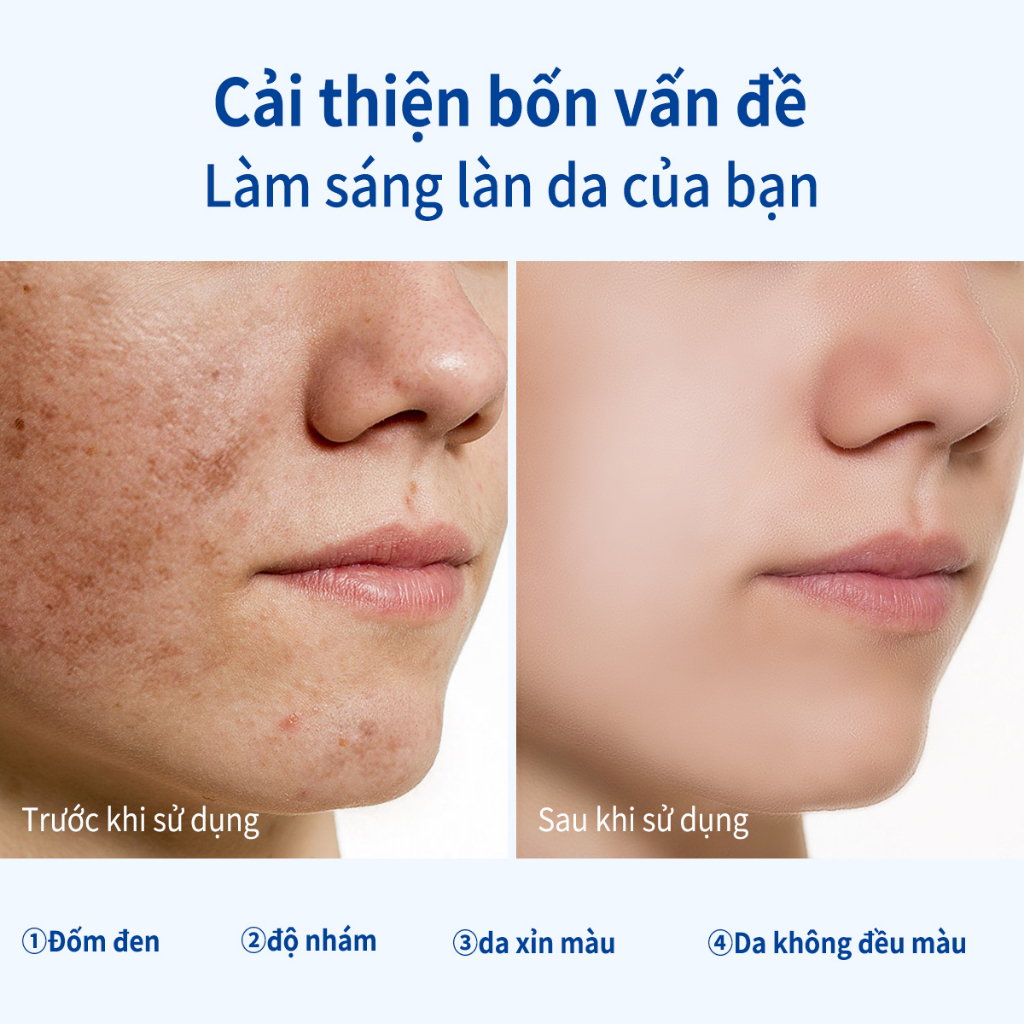 AISASEA làm trắng 5%Niacinamide+3%arbutin+ 3%panthenol 20ml thâm Làm sáng màu da làm trắng HyaluronicSerum