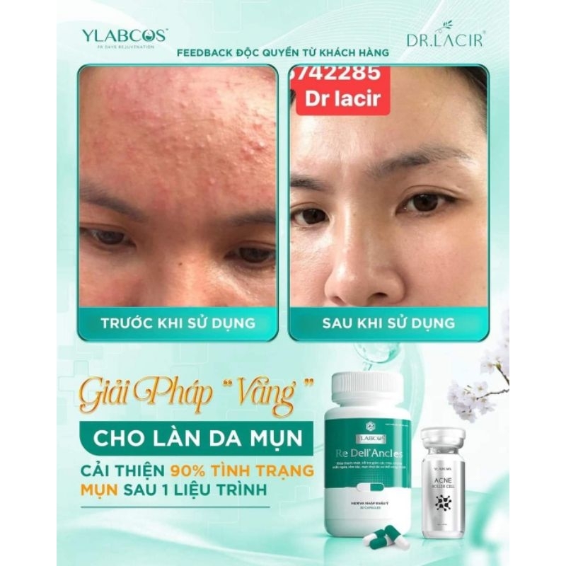 Viên uống ngừa mụn Re Dell' Ancles Ylabcos Dr Lacir
