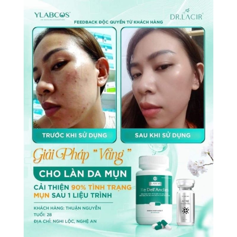 Viên uống ngừa mụn Re Dell' Ancles Ylabcos Dr Lacir