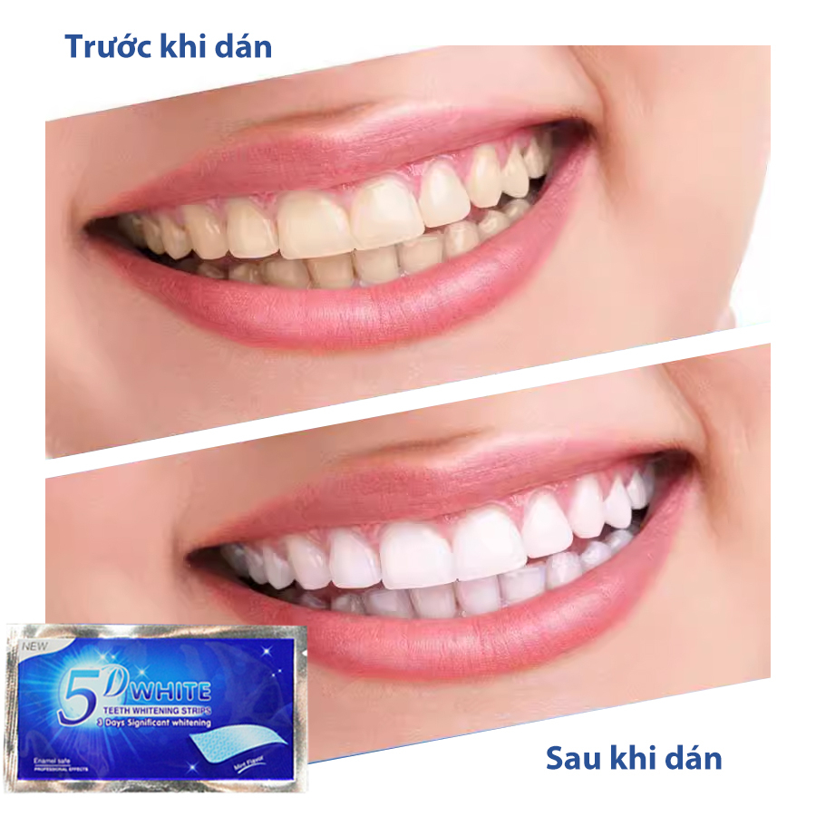 Hộp 7 gói miếng dán trắng răng 5d white Teeth Whitening Strips, Miếng dán tẩy trắng răng,Tẩy trắng răng tại nhà