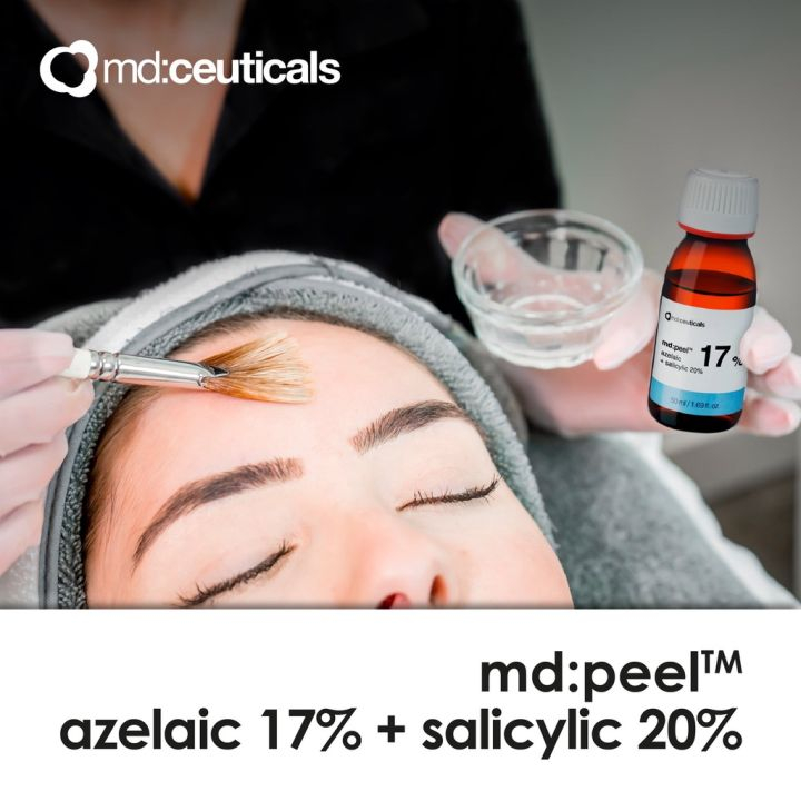 Peel mụn & giảm thâm Md:ceuticals md:peel azelaic 17% + salicylic 20%