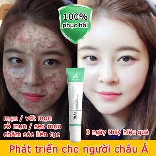 Kem dưỡng da MỤN trắng da 20g dưỡng ẩm làm sáng da làn da mịn màng dùng cho mụn viêm, mụn bọc, mụn mủ, mụn trứng cá