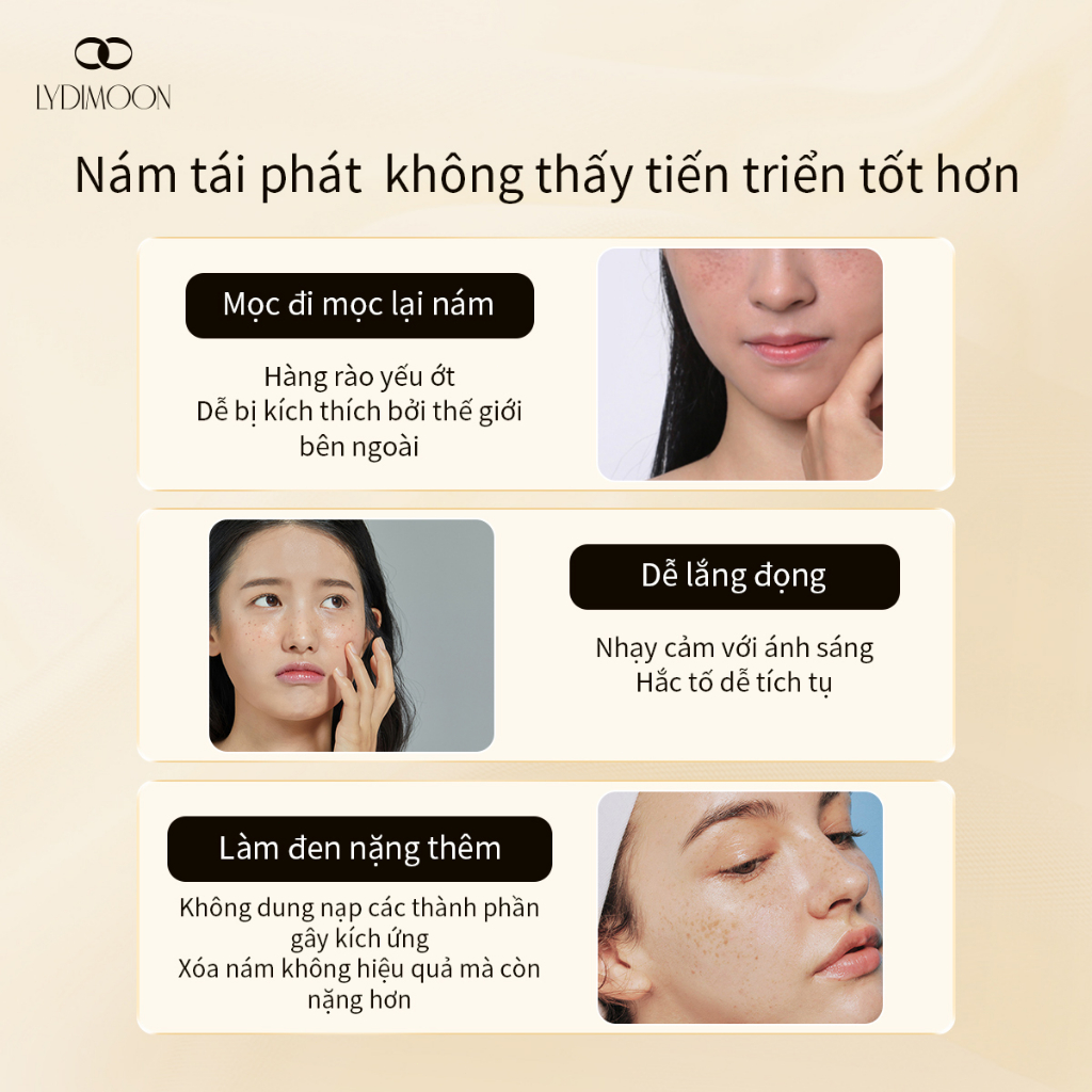 Kem nám tàn nhang kem đặc chấm tàn nhang nám tàn nhang 20g Loại bỏ các đốm đen sâu làm sáng trắng da