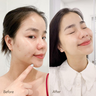 Nước Thần Neogen Dermalogy Real Ferment Micro Essence - 10ml